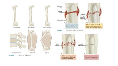 Bone Homeostasis